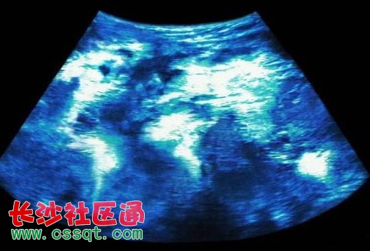 新生儿嘴、脚严重畸形,全身数十处异常!产前五